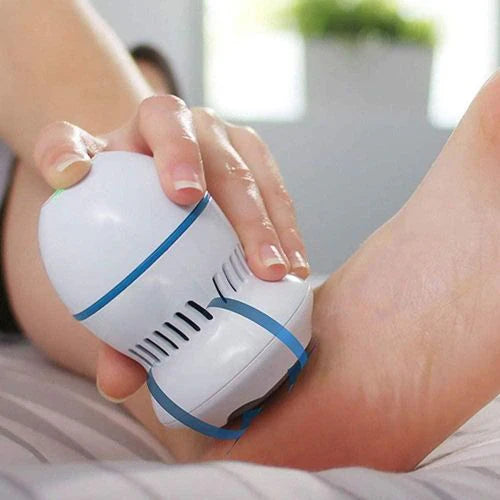 HeelEase™ – Talons Secs & Crevassés ? Solution Express en 1 Minute