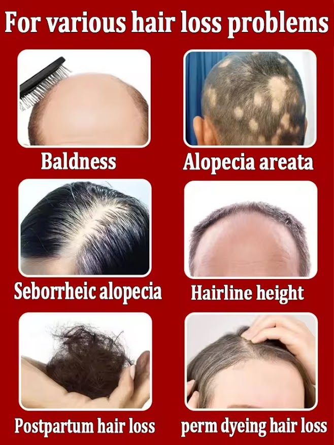 huile essentielle pour la chute du cheveux