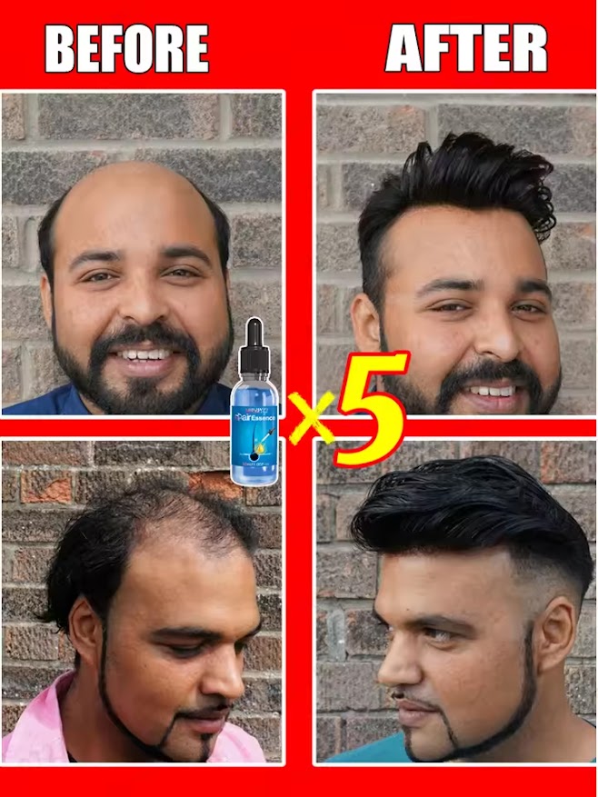 huile essentielle pour la chute du cheveux