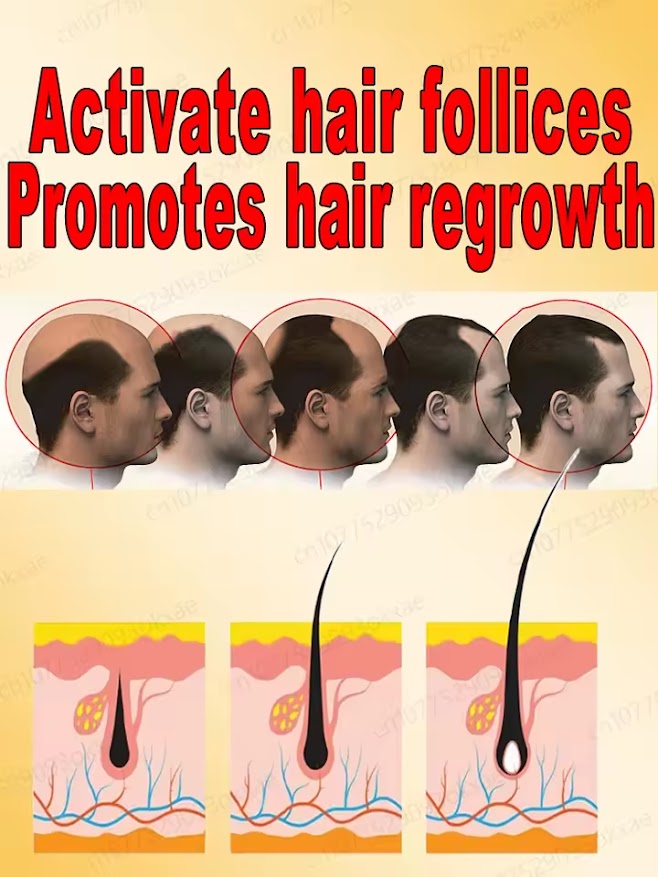 huile essentielle pour la chute du cheveux
