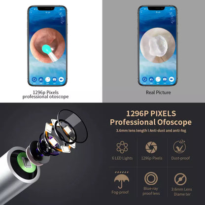 Kit de Nettoyage des Oreilles Sans Fil avec Caméra HD & Lumière LED