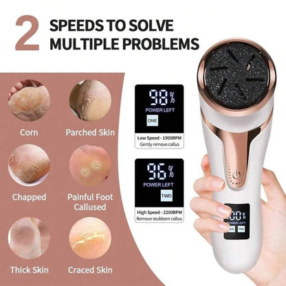 SoftFeet™ Râpe à Pied Électrique Anti-Callosités – Pédicure Waterproof IPX7
