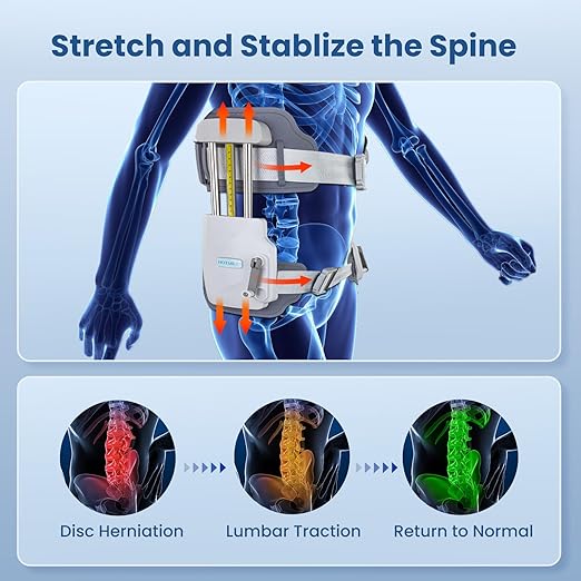 OrthoRelief™ Dispositif Professionnel de Traction Lombaire – Soulagement & Décompression du Dos