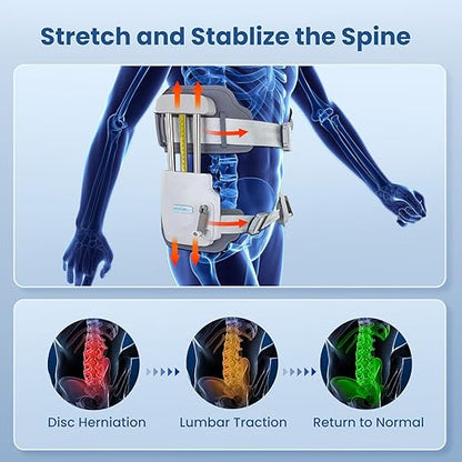 OrthoRelief™ Dispositif Professionnel de Traction Lombaire – Soulagement & Décompression du Dos