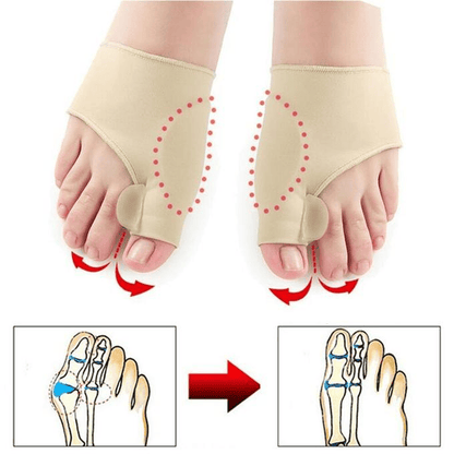 Correcteur Orthopédique - l’hallux valgus (oignon)
