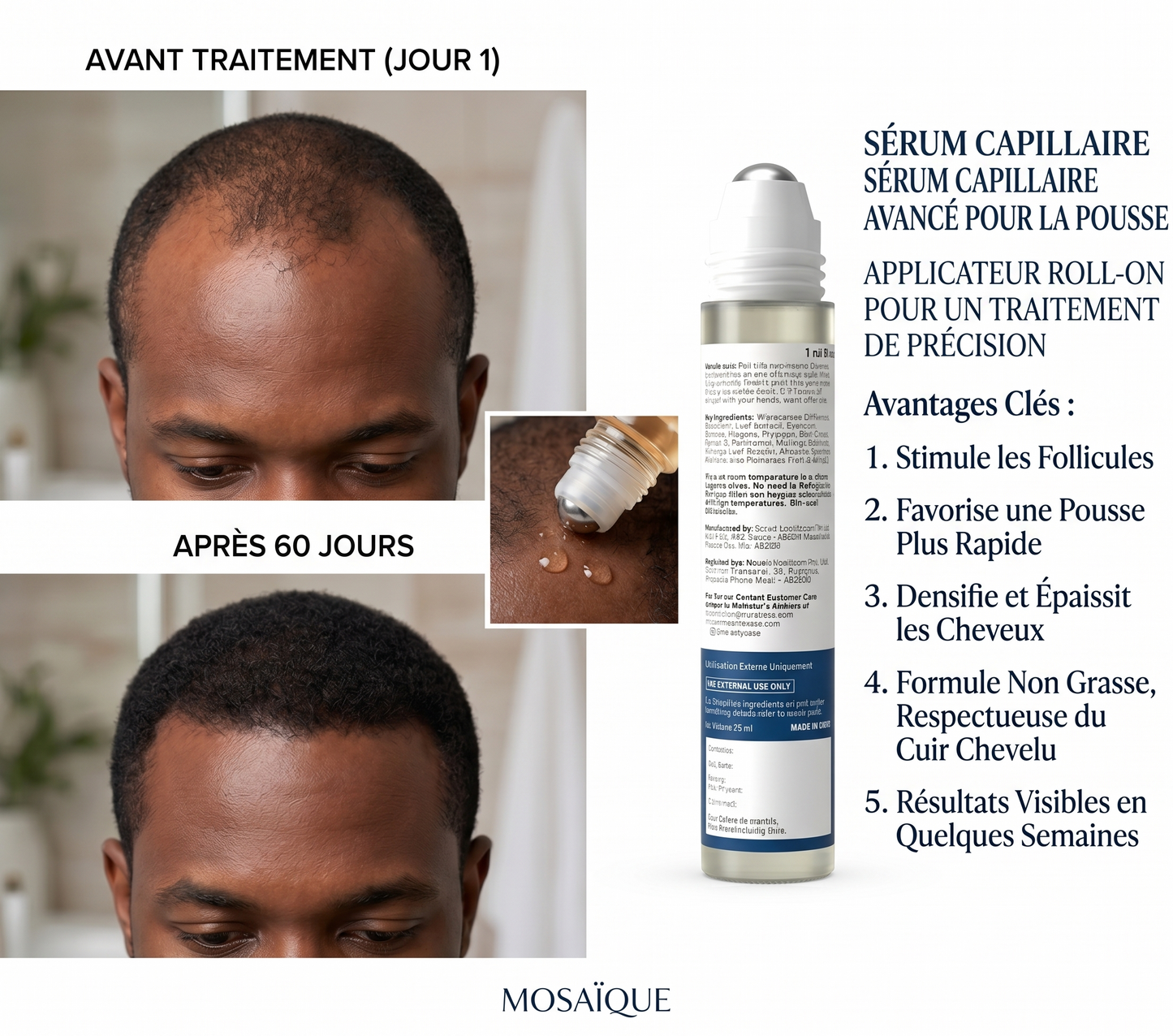HairGrowth™ Sérum Roll-On Croissance Cheveux – Soin Fortifiant