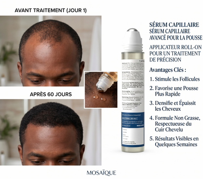 HairGrowth™ Sérum Roll-On Croissance Cheveux – Soin Fortifiant