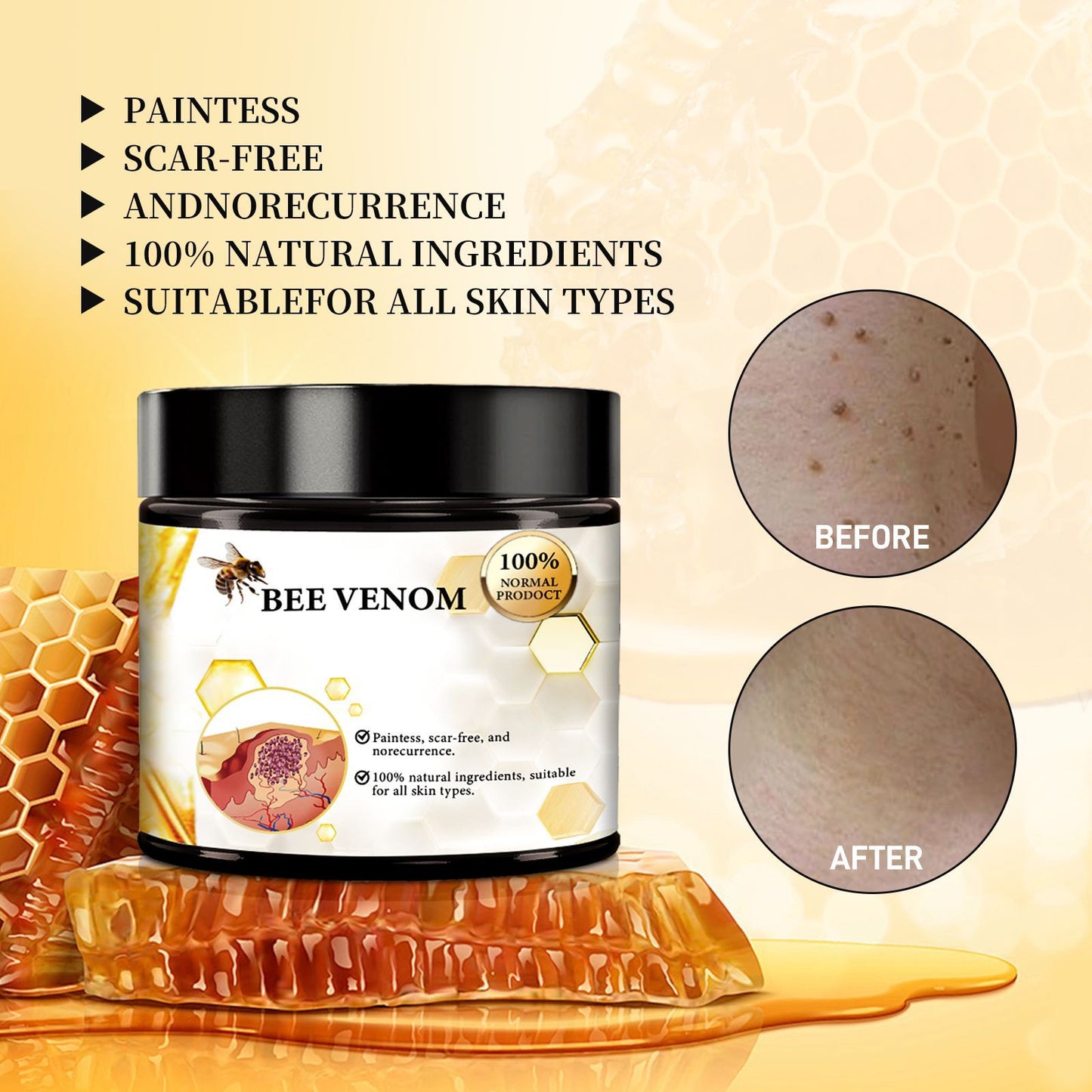 BeeGlow™ Crème au Venin d’Abeille – Anti-Boutons & Réparatrice de Cicatrices
