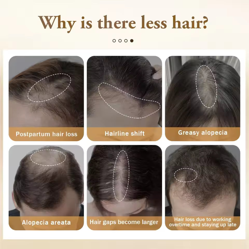 Biotine Forte – Huile Croissance et Renforcement Capillaire