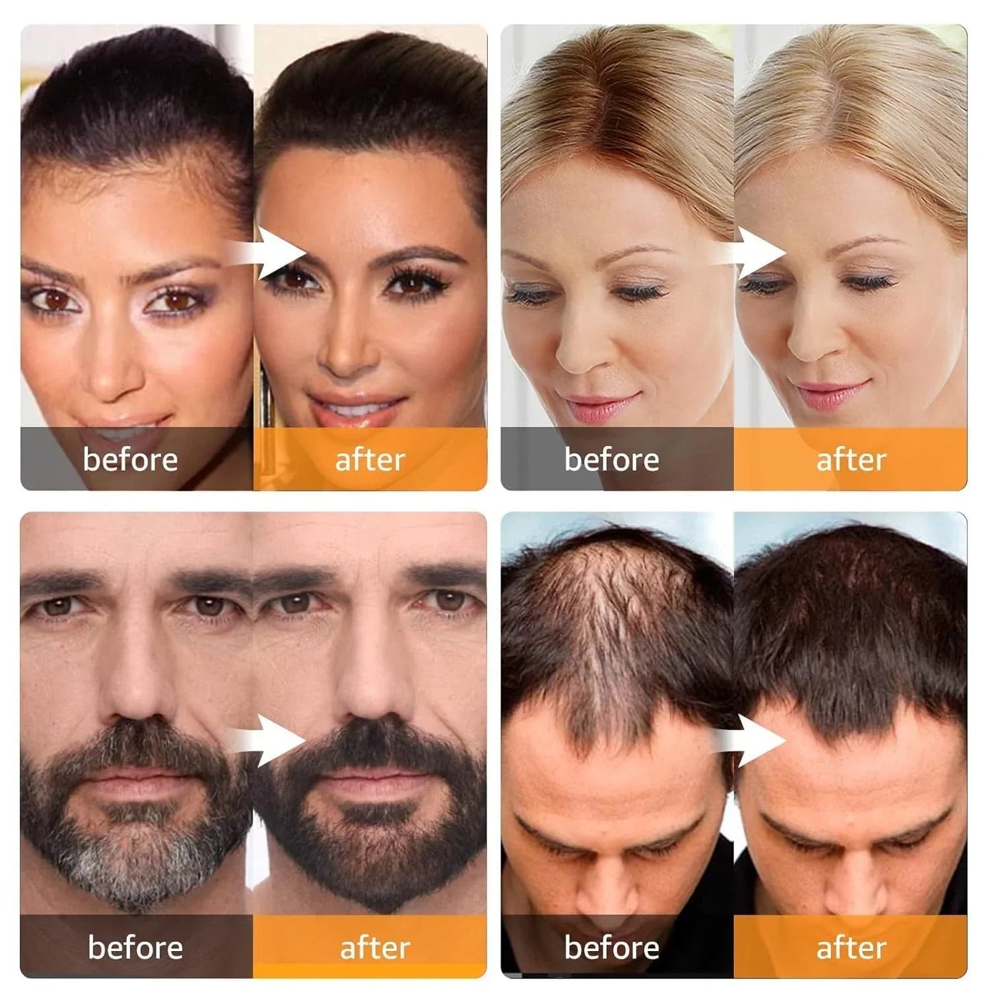 LANLSLO™ Poudre Ligne de Cheveux Imperméable – Kit Ombre avec Brosse pour Look Naturel