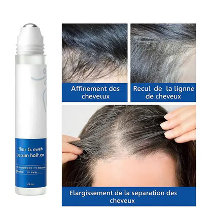 HairGrowth™ Sérum Roll-On Croissance Cheveux – Soin Fortifiant