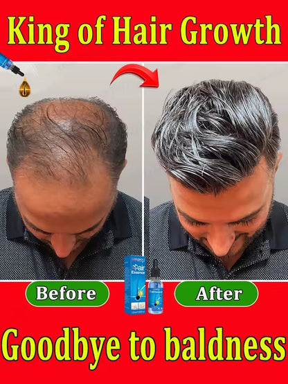 huile essentielle pour la chute du cheveux